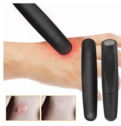 ItchAway™ Bite Relief Pen – Instant Heat-Based Itch Relief